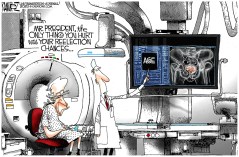 MRI Scan