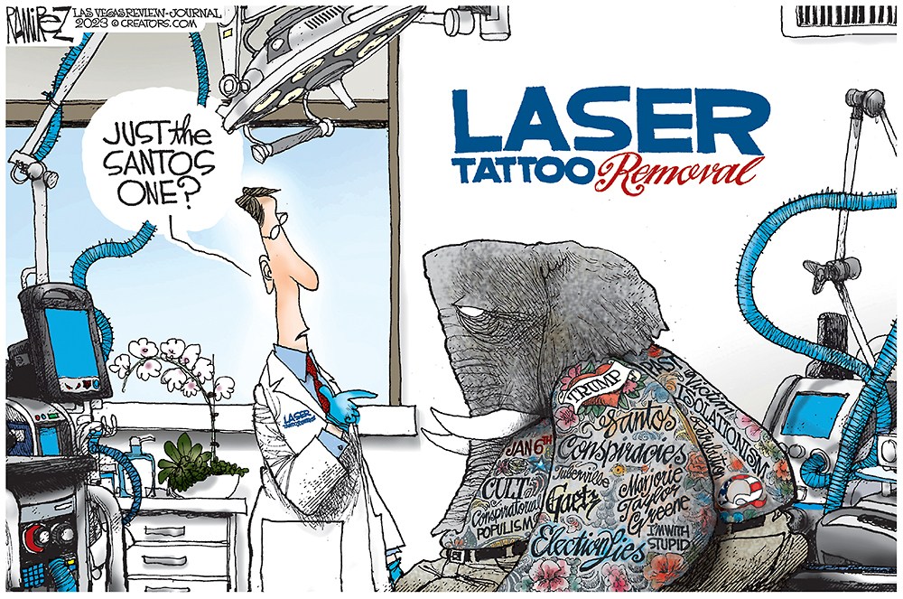 Tattoo Removal