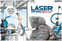 Tattoo Removal