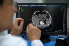 Dr. Zhu Kelei goes over CT scans of Qiu Sijun, a retired bricklayer whose pancreatic cancer was detected at an early stage via a new AI-powered tool, at the Affiliated People's Hospital of Ningbo University, in Ningbo, China, on Wednesday, Nov. 5, 2025. The PANDA software had flagged Qiu’s routine CT scan before he had any symptoms of pancreatic cancer. (Andrea Verdelli/The New York Times)